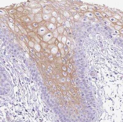 Immunohistochemistry-Paraffin: Uridine Phosphorylase 1/UPP1 Antibody [NBP2-30852]
