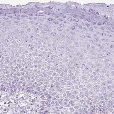 Immunohistochemistry-Paraffin: Uridine Phosphorylase 1/UPP1 Antibody [NBP2-30852]