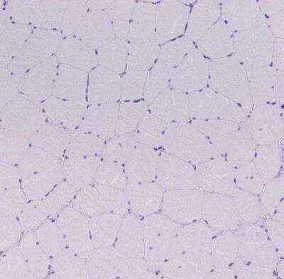 Immunohistochemistry-Paraffin: Uridine Phosphorylase 1/UPP1 Antibody [NBP2-30852]