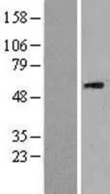 Western Blot: u-Plasminogen Activator/Urokinase Overexpression Lysate [NBL1-14486]