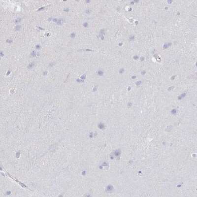 Immunohistochemistry-Paraffin: Uromodulin Antibody [NBP2-33393]