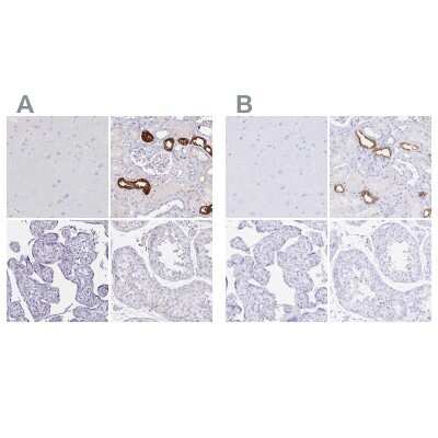 Immunohistochemistry-Paraffin: Uromodulin Antibody [NBP2-33393]
