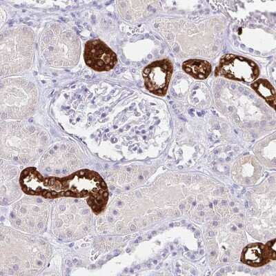 Immunohistochemistry-Paraffin: Uromodulin Antibody [NBP2-33393]