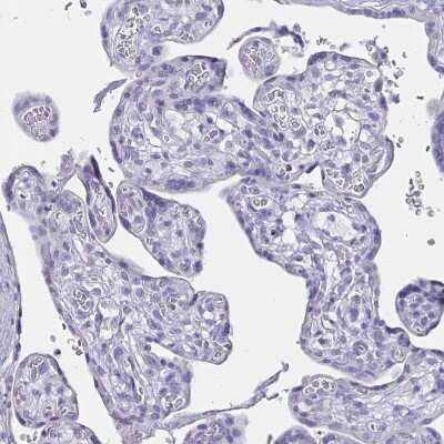 Immunohistochemistry-Paraffin: Uromodulin Antibody [NBP2-33393]