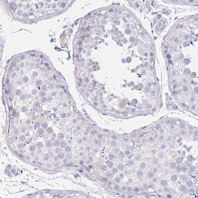 Immunohistochemistry-Paraffin: Uromodulin Antibody [NBP2-33393]