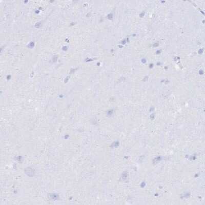 Immunohistochemistry-Paraffin: Uromodulin Antibody [NBP2-33730]