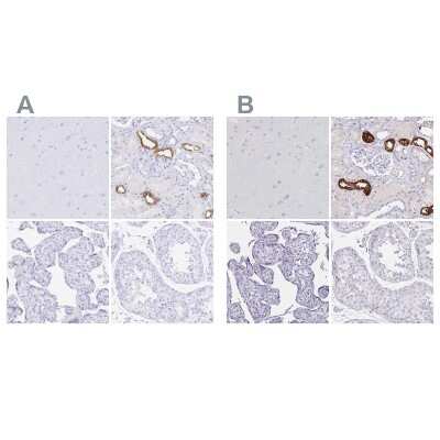 Immunohistochemistry-Paraffin: Uromodulin Antibody [NBP2-33730]