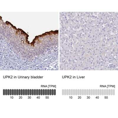 Immunohistochemistry-Paraffin: Uroplakin II Antibody [NBP2-33389]