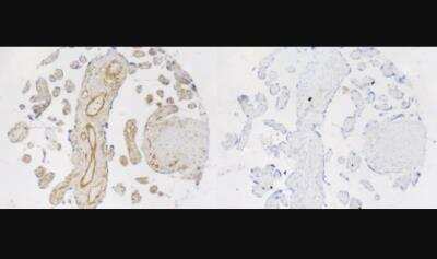 Immunohistochemistry: Uroplakin IIIB Antibody [NBP1-92564]