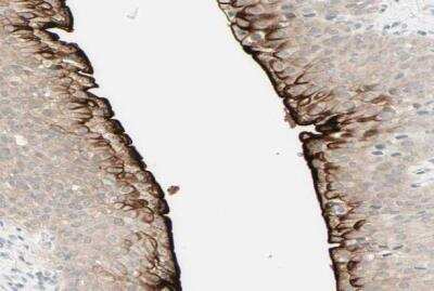 Immunohistochemistry-Paraffin: Uroplakin IIIB Antibody [NBP1-92564]