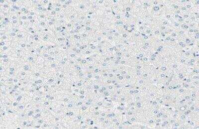 Immunohistochemistry-Paraffin: Uroplakin IIIB Antibody [NBP1-92564]