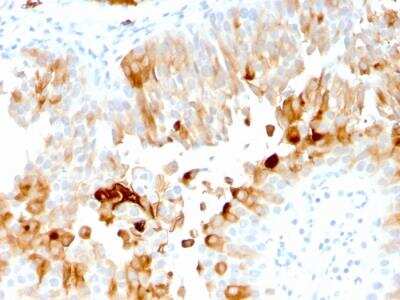 Immunohistochemistry-Paraffin: Uroplakin Ia Antibody (UPK1A/2921) - Azide and BSA Free [NBP2-79868]