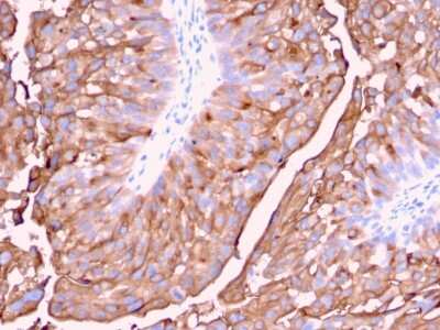 Immunohistochemistry-Paraffin: Uroplakin Ia Antibody (UPK1A/2921) [NBP2-79733]