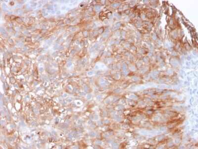 Immunohistochemistry-Paraffin: Uroplakin Ia Antibody (UPK1A/2925) [NBP2-79735]