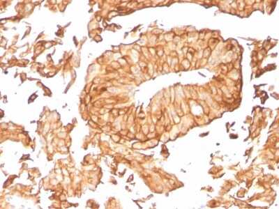 Immunohistochemistry-Paraffin: Uroplakin Ib Antibody (UPK1B/3081) [NBP2-79799]