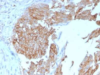 Immunohistochemistry-Paraffin: Uroplakin Ib Antibody (UPK1B/3102) [NBP2-79800]