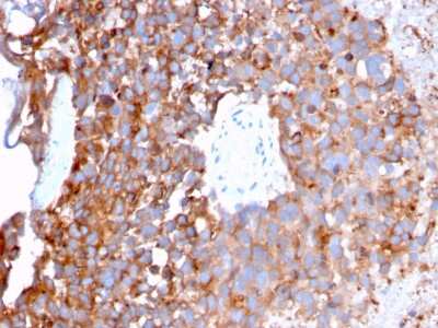 Immunohistochemistry-Paraffin: Uroplakin Ib Antibody (UPK1B/3273) [NBP2-79801]