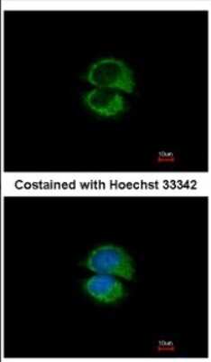 Immunocytochemistry/ Immunofluorescence: Use1/UBE2Z Antibody [NBP2-20822]