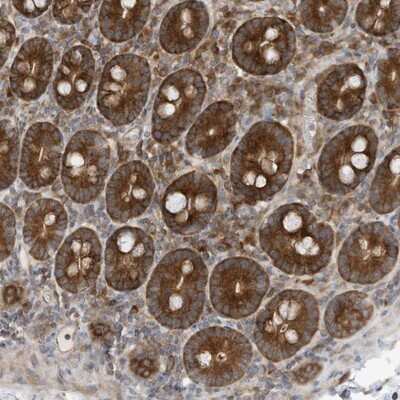 Immunohistochemistry-Paraffin: Use1/UBE2Z Antibody [NBP1-82785]