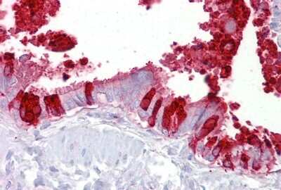 Immunohistochemistry-Paraffin: Uteroglobin/SCGB1A1 Antibody [NBP1-57961]