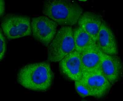 Immunocytochemistry/ Immunofluorescence: Uteroglobin/SCGB1A1 Antibody (JU34-03) [NBP2-75705]