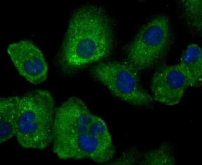 Immunocytochemistry/ Immunofluorescence: Uteroglobin/SCGB1A1 Antibody (JU34-03) [NBP2-75705]