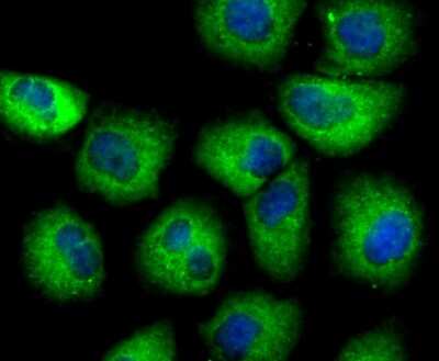 Immunocytochemistry/ Immunofluorescence: Uteroglobin/SCGB1A1 Antibody (JU34-03) [NBP2-75705]