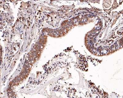 Immunohistochemistry-Paraffin: Uteroglobin/SCGB1A1 Antibody (JU34-03) [NBP2-75705]