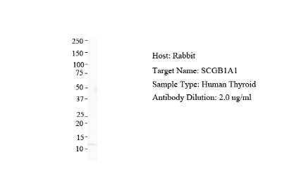 Western Blot: Uteroglobin/SCGB1A1 Antibody [NBP1-57961]
