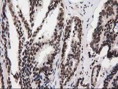 Immunohistochemistry-Paraffin: V-type proton ATPase subunit F Antibody (OTI1B8) [NBP2-03498]