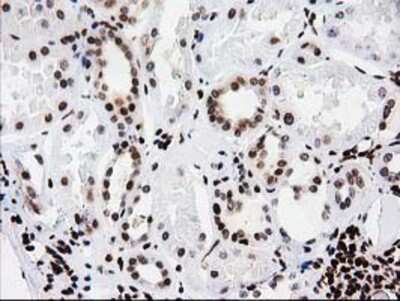 Immunohistochemistry-Paraffin: V-type proton ATPase subunit F Antibody (OTI1B8) [NBP2-03498]
