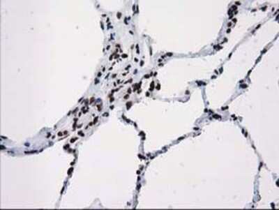 Immunohistochemistry-Paraffin: V-type proton ATPase subunit F Antibody (OTI1B8) [NBP2-03498]