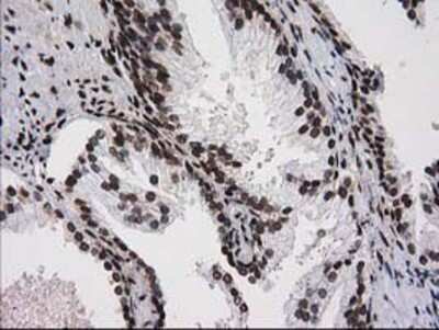 Immunohistochemistry-Paraffin: V-type proton ATPase subunit F Antibody (OTI1B8) [NBP2-03498]