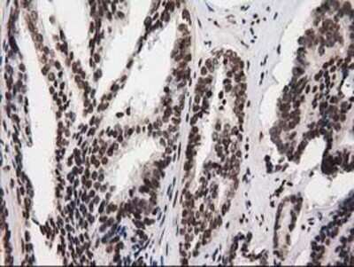 Immunohistochemistry: V-type proton ATPase subunit F Antibody (OTI1B8) - Azide and BSA Free [NBP2-74863]