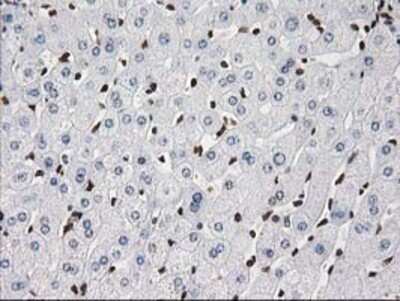 Immunohistochemistry: V-type proton ATPase subunit F Antibody (OTI1B8) - Azide and BSA Free [NBP2-74863]