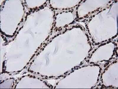 Immunohistochemistry: V-type proton ATPase subunit F Antibody (OTI1B8) - Azide and BSA Free [NBP2-74863]