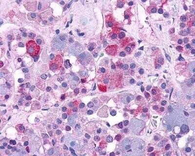 Immunohistochemistry-Paraffin: V1b Vasopressin R/AVPR1B Antibody - BSA Free [NLS266]