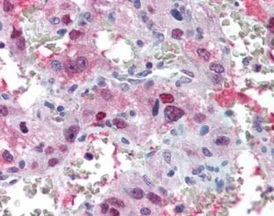 Immunohistochemistry-Paraffin: V1b Vasopressin R/AVPR1B Antibody - BSA Free [NLS266]