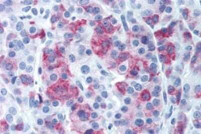 Immunohistochemistry-Paraffin: V1b Vasopressin R/AVPR1B Antibody - BSA Free [NLS266]