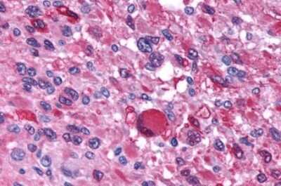 Immunohistochemistry-Paraffin: V1b Vasopressin R/AVPR1B Antibody - BSA Free [NLS266]