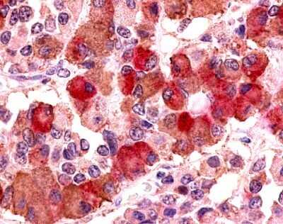 Immunohistochemistry-Paraffin: V1b Vasopressin R/AVPR1B Antibody - BSA Free [NLS3739]