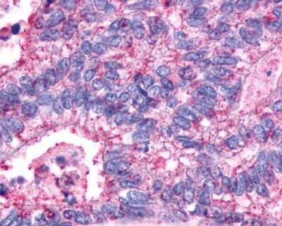 Immunohistochemistry-Paraffin: V2 Vasopressin R/AVPR2 Antibody - BSA Free [NLS273]