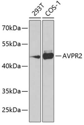 Western Blot: V2 Vasopressin R/AVPR2 AntibodyBSA Free [NBP2-93162]