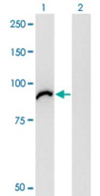 Western Blot: VAC14 Antibody (3B2) [H00055697-M03]