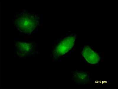 Immunocytochemistry/ Immunofluorescence: VAC14 Antibody [H00055697-B01P]