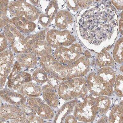 Immunohistochemistry: VAC14 Antibody [NBP1-89002]