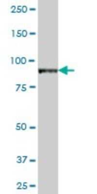 Western Blot: VAC14 Antibody [H00055697-B01P]