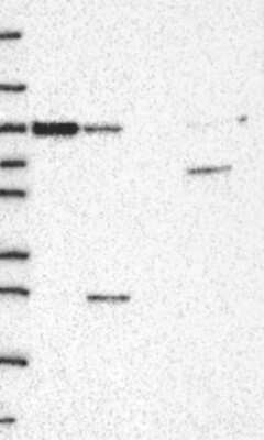 Western Blot: VAC14 Antibody [NBP3-17962]