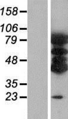 Western Blot: VAC14 Overexpression Lysate [NBP2-06882]