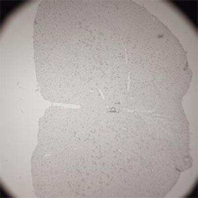 Immunohistochemistry-Paraffin: VAChT/SLC18A3 Antibody [NB100-91348]